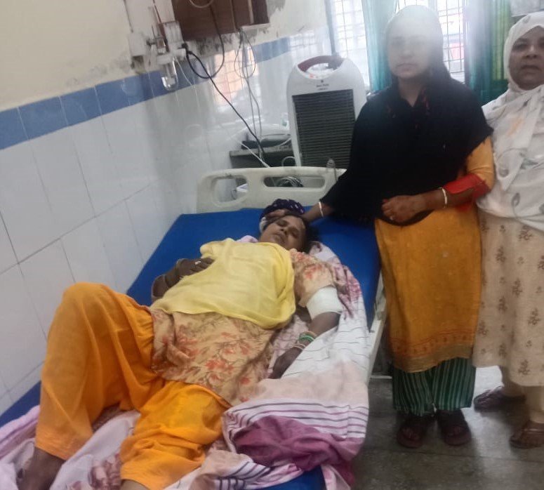 थराली में बंदरों ने महिला पर हमला कर किया जख्मी