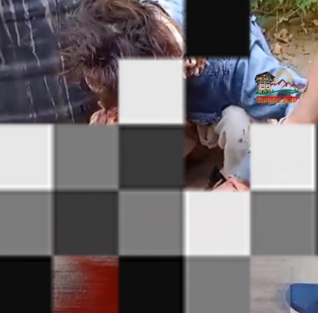 उत्तराखंड में गुलदार का आतंक : नीरज पर हमला, 30 मिनट तक लड़ी जिंदगी की जंग